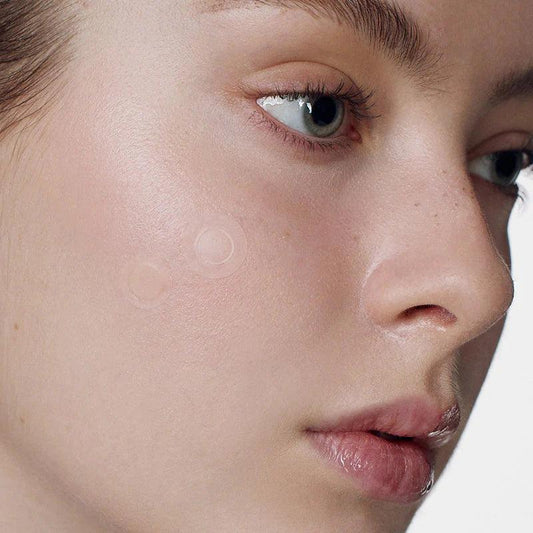 Some By Mi 30 days Miracle Micro Pin Spot Patch 9 St.